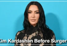 Kim Kardashian Before Surgery and After: What Plastic Surgeons Say About Her Transformation Kim Kardashian before surgery and after full face comparison 2007 vs 2024