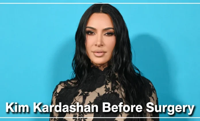 Kim Kardashian Before Surgery and After – Full Comparison Kim Kardashian before surgery and after full face comparison 2007 vs 2024