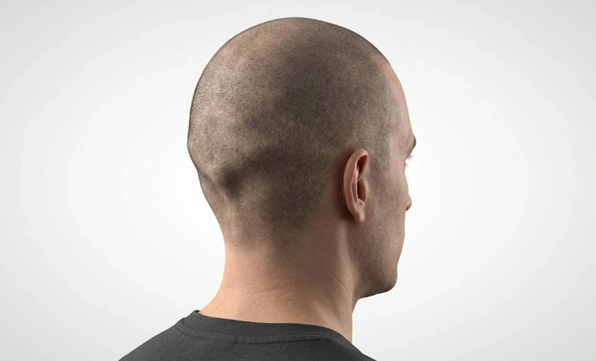 Side profile of a man with a buzz cut showing the back of the head and occipital contour