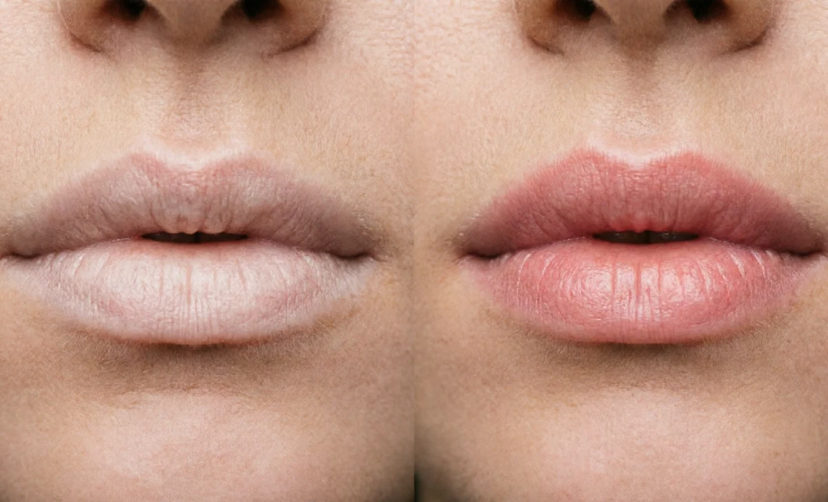 Lip blush healing process ghost phase comparison: pale lips at day 10 and the final soft pink blush at week 4.