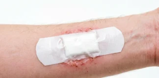 Close-up of a fresh wound showing mole removal healing stages in the first 24 hours after procedure.