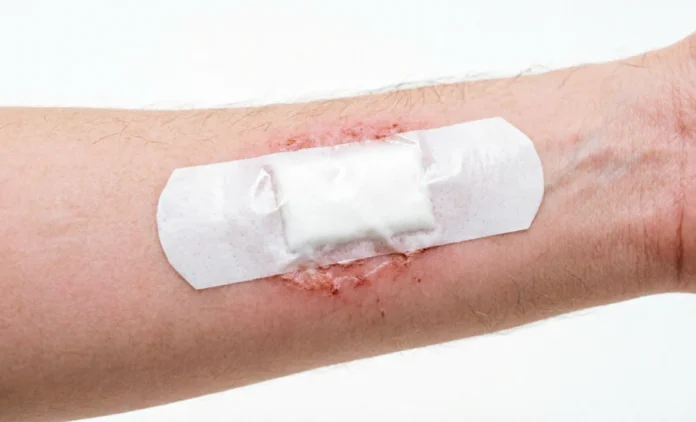 Close-up of a fresh wound showing mole removal healing stages in the first 24 hours after procedure.