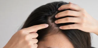 Woman checking scalp tender in one spot by pressing gently on her head