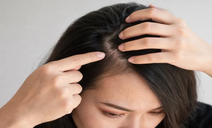 Woman checking scalp tender in one spot by pressing gently on her head